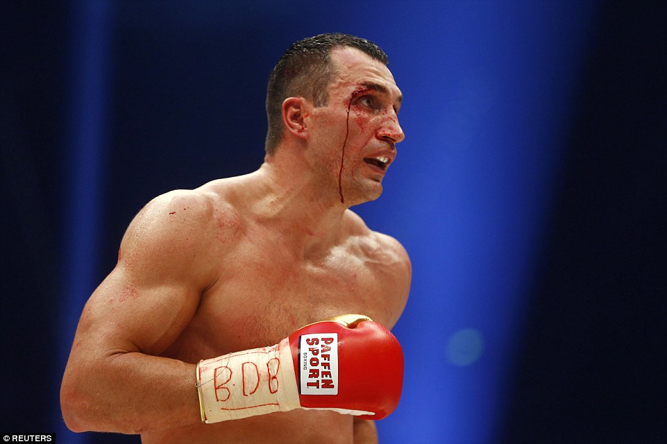 2EE3BD0F00000578-3338106-Klitschko_bled_profusely_from_his_face_after_being_cut_the_39_ye-a-93_1448799030334